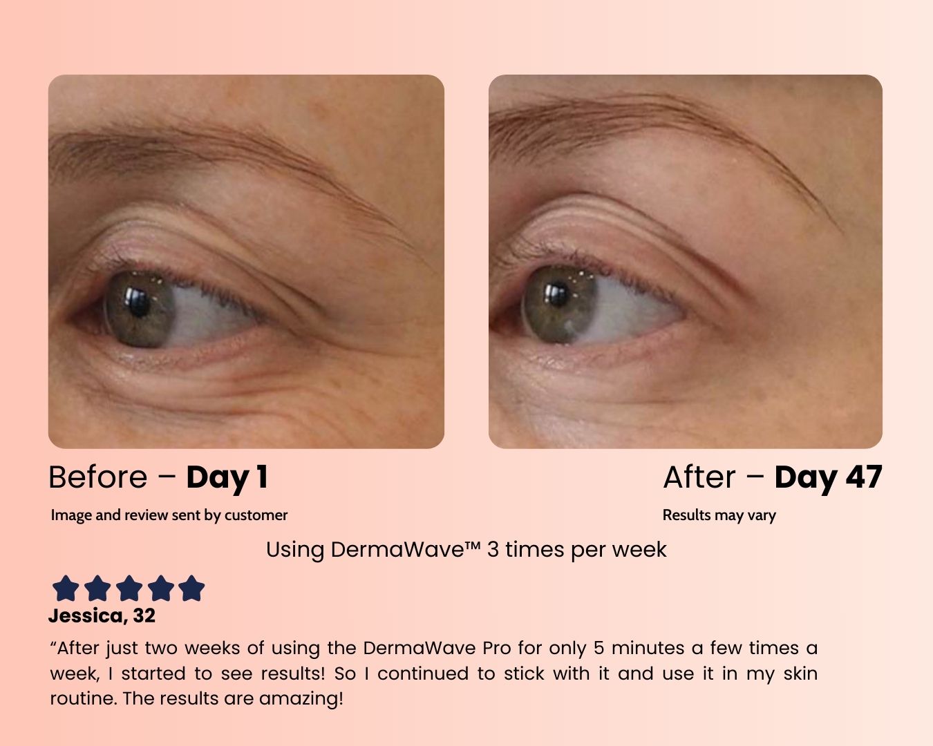 DermaWave Pro™